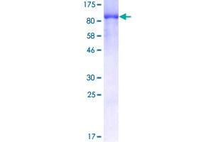 Image no. 1 for Eukaryotic Translation Initiation Factor 4B (EIF4B) (AA 1-611) protein (GST tag) (ABIN1352593)