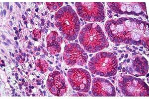 Human Small Intestine: Formalin-Fixed, Paraffin-Embedded (FFPE)
