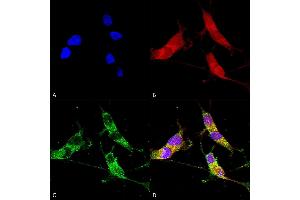 Immunocytochemistry/Immunofluorescence analysis using Mouse Anti-VGLUT2 Monoclonal Antibody, Clone S29-29 (ABIN2483744). (Solute Carrier Family 17 (Vesicular Glutamate Transporter), Member 6 (SLC17A6) (AA 501-582) anticorps (FITC))