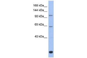 WB Suggested Anti-BACH2 Antibody Titration: 0. (BACH2 anticorps  (Middle Region))