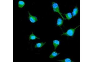 IF analysis of RALB using anti-RALB antibody (ABIN3043919).