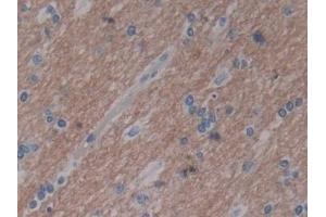 Detection of 15-LO-2 in Human Cerebrum Tissue using Polyclonal Antibody to 15-Lipoxygenase-2 (15-LO-2) (ALOX15B anticorps  (AA 253-490))