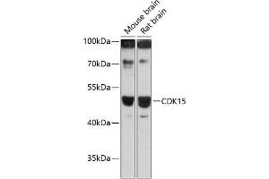 Western blot analysis of extracts of various cell lines, using CDK15 antibody (ABIN6131335, ABIN6138309, ABIN6138310 and ABIN6217056) at 1:3000 dilution.