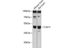 Western blot analysis of extracts of various cell lines, using CDK15 antibody (ABIN6131335, ABIN6138309, ABIN6138310 and ABIN6217056) at 1:3000 dilution. (Cyclin-Dependent Kinase 15 (ALS2CR7) (AA 271-400) anticorps)