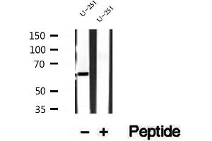 Western blot analysis of extracts of U-251 cells, using Sur-8 antibody. (SHoc2/Sur8 anticorps  (C-Term))