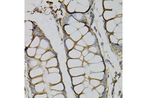 Immunohistochemistry of paraffin-embedded human colon using AZGP1 Antibody (ABIN5973101) at dilution of 1/100 (40x lens).