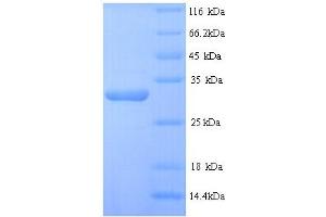 SDS-PAGE (SDS) image for Desmoplakin (DSP) (AA 78-300), (partial) protein (His tag) (ABIN5713408)