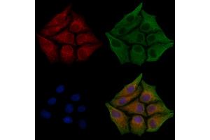 ABIN6261746 and ABIN6268882 staining HepG2 cells(30 min of 4uM Forskolin treatment) by IF/ICC. (Fibronectin anticorps  (C-Term))