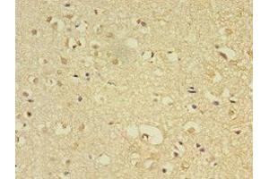 Immunohistochemistry of paraffin-embedded human brain tissue using ABIN7158118 at dilution of 1:100 (FLRT1 anticorps  (AA 21-289))