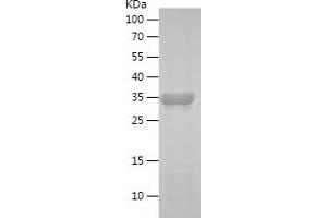 Western Blotting (WB) image for Replication Protein A1, 70kDa (RPA1) (AA 16-162) protein (His-IF2DI Tag) (ABIN7124825)