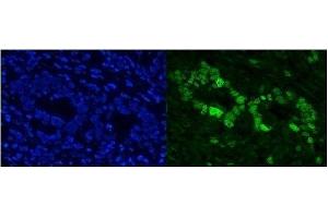 IF analysis of Cbx8 using anti-Cbx8 antibody (ABIN7599341).