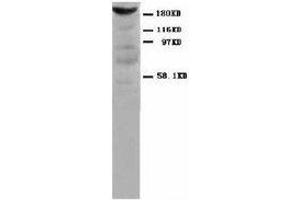 Image no. 1 for anti-Myosin, Light Chain 1, Alkali, Skeletal, Fast (MYL1) antibody (ABIN1502212) (MYL1 anticorps)