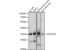 Western blot analysis of extracts of various cell lines, using CCDC124 antibody  at 1:1000 dilution. (CCDC124 anticorps  (AA 1-223))