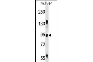 RASAL1 Antibody (Center) (ABIN656393 and ABIN2845688) western blot analysis in mouse liver tissue lysates (35 μg/lane). (RASAL1 anticorps  (AA 309-337))