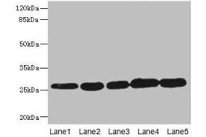 Western blot All lanes: GSTK1 antibody at 0. (GSTK1 anticorps  (AA 1-226))