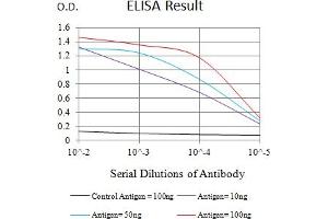 Black line: Control Antigen (100 ng),Purple line: Antigen (10 ng), Blue line: Antigen (50 ng), Red line:Antigen (100 ng)