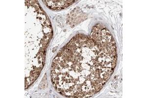 Immunohistochemical staining of human testis with MAGEB4 polyclonal antibody  shows moderate cytoplasmic and nuclear positivity in cells in seminiferus ducts at 1:200-1:500 dilution. (MAGEB4 anticorps)