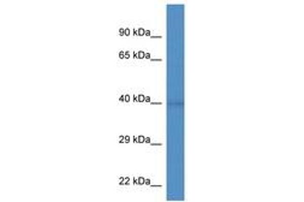 WDR92 抗体  (AA 155-204)