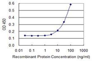 Detection limit for recombinant GST tagged CTRB1 is 3 ng/ml as a capture antibody.