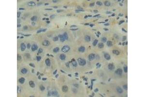 Figure. (PABPC1L anticorps  (AA 12-176))