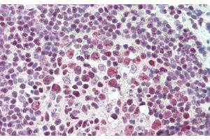 Detection of DEP1 in Human Tonsil Tissue using Polyclonal Antibody to Density Enhanced Phosphatase 1 (DEP1)