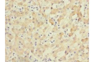 Immunohistochemistry of paraffin-embedded human liver tissue using ABIN7176327 at dilution of 1:100 (ZNF462 anticorps  (AA 2223-2506))