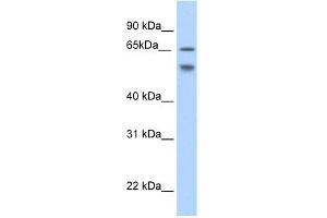 WB Suggested Anti-RBM35B Antibody Titration:  2. (ESRP2 anticorps  (N-Term))