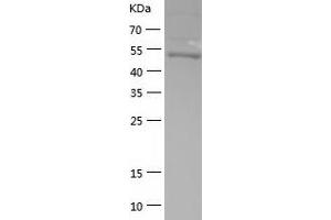 Western Blotting (WB) image for GTPase Activating Protein (SH3 Domain) Binding Protein 1 (G3BP1) (AA 1-466) protein (His tag) (ABIN7123227) (G3BP1 Protein (AA 1-466) (His tag))