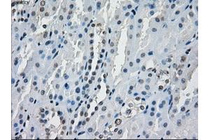 Immunohistochemical staining of paraffin-embedded endometrium tissue using anti-AURKCmouse monoclonal antibody. (Aurora Kinase C anticorps)