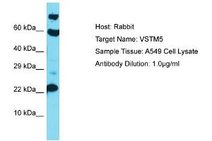 Host: Rabbit Target Name: VSTM5 Sample Type: A549 Whole Cell lysates Antibody Dilution: 1. (VSTM5 anticorps  (C-Term))