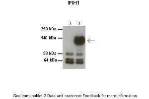 Lanes:   1: 20ug HEK293T no transfection, 2: 20ug HEK293T 3Flag-MDA5/IFIH1  Primary Antibody Dilution:   1:1000  Secondary Antibody:   Anti-rabbit HRP  Secondary Antibody Dilution:   1:1000  Gene Name:   IFIH1  Submitted by:   Dr. (IFIH1 anticorps  (Middle Region))