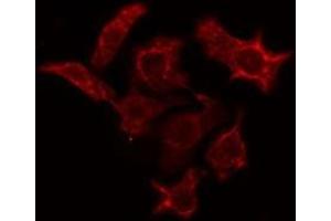 ABIN6274943 staining A549 cells by IF/ICC.