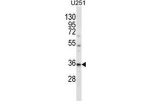 VPS37B Antibody (Center) western blot analysis in U251 cell line lysates (35 µg/lane).