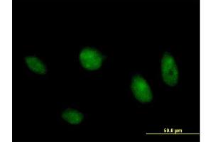 Immunofluorescence of purified MaxPab antibody to MAPK8 on HeLa cell. (JNK anticorps  (AA 1-427))