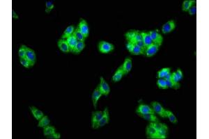 Immunofluorescence staining of HepG2 cells with ABIN7153159 at 1:133, counter-stained with DAPI.