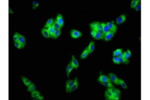 Immunofluorescence staining of HepG2 cells with ABIN7153159 at 1:133, counter-stained with DAPI. (FFAR1 anticorps  (AA 143-178))