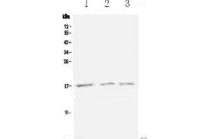Western blot analysis of Lymphotactin using anti-Lymphotactin antibody . (XCL1 anticorps  (AA 22-114))