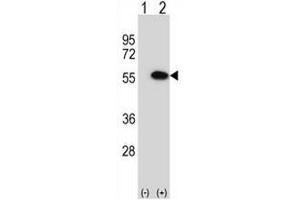 Western blot analysis of MINA (arrow) using rabbit polyclonal MINA Antibody (N-term) . (MINA anticorps  (N-Term))