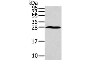 Western Blot analysis of Huvec cell using HOXC6 Polyclonal Antibody at dilution of 1/550