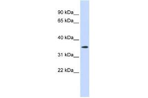 GPR6 antibody used at 1 ug/ml to detect target protein. (GPR6 anticorps  (N-Term))