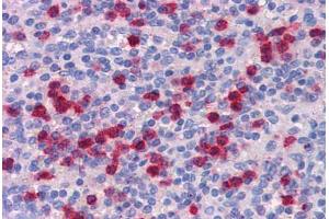 Human Spleen: Formalin-Fixed, Paraffin-Embedded (FFPE)