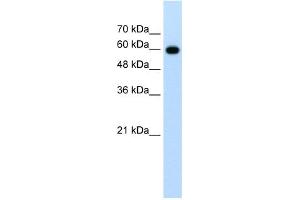 WB Suggested Anti-CDC23 Antibody Titration:  1. (CDC23 anticorps  (N-Term))