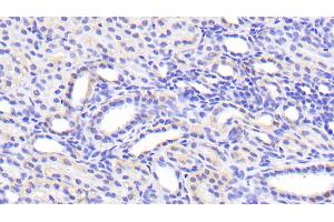 Detection of SLC39A7 in Human Kidney Tissue using Polyclonal Antibody to Solute Carrier Family 39, Member 7 (SLC39A7)