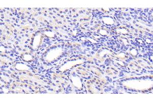 Detection of SLC39A7 in Human Kidney Tissue using Polyclonal Antibody to Solute Carrier Family 39, Member 7 (SLC39A7) (SLC39A7 anticorps  (AA 171-469))