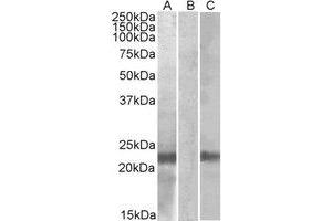Western Blotting (WB) image for anti-Cystatin 8 (CST8) (Internal Region) antibody (ABIN2464863) (CST8 anticorps  (Internal Region))