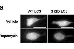 Western Blotting (WB) image for anti-Microtubule-Associated Protein 1 Light Chain 3 gamma (MAP1LC3C) (pSer12) antibody (ABIN2970987)