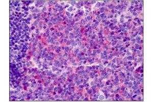 Human Tonsil: Formalin-Fixed, Paraffin-Embedded (FFPE)