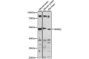 Western blot analysis of extracts of various cell lines, using W antibody (ABIN7271020) at 1:1000 dilution. (WARS2 anticorps  (AA 211-360))