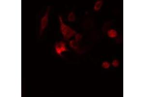 ABIN6277987 staining  Hela cells by IF/ICC. (Calretinin anticorps  (Internal Region))