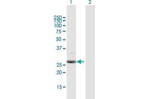 Western Blot analysis of PSMB4 expression in transfected 293T cell line by PSMB4 MaxPab polyclonal antibody. (PSMB4 anticorps  (AA 1-264))